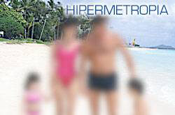 hipermetropia