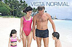 vista normal